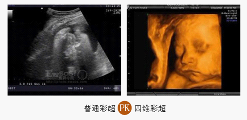 杭州妇科医院——女性健康的守护者