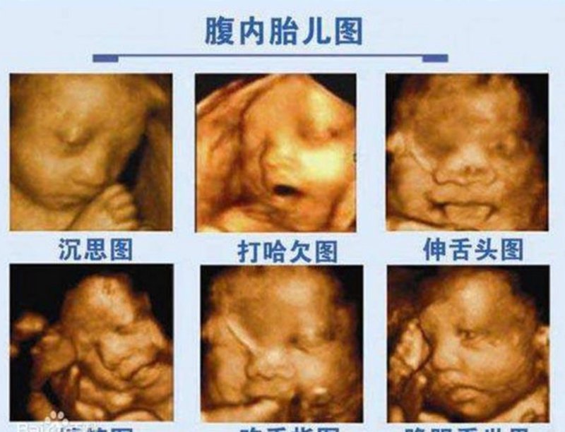 杭州妇科医院:打造女性健康守护者